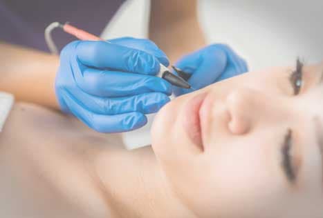 Electrolysis